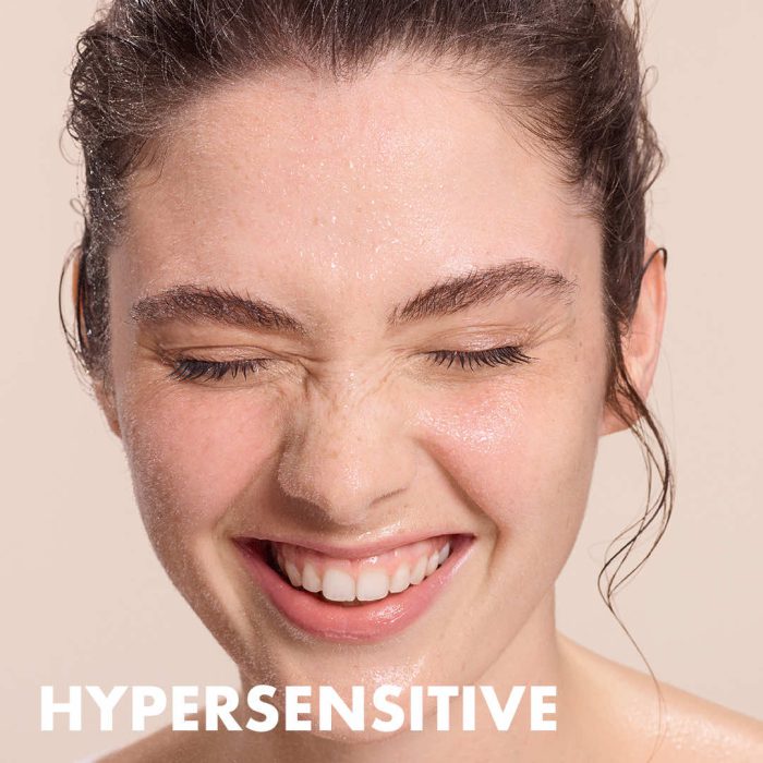 Hypersensitive