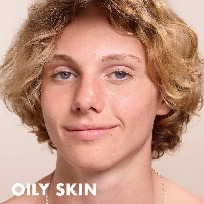 Oily Skin